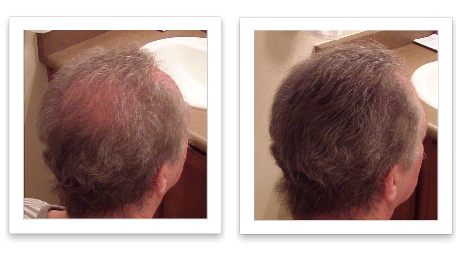 Caboki All-Natural Hair Building Fiber. Make Thin Hair Look 10X Fuller Instantly. Eliminate the Appearance of Bald Spot and Thinning Hair (30G, 90-Day Supply). Medium Brown - Image 8