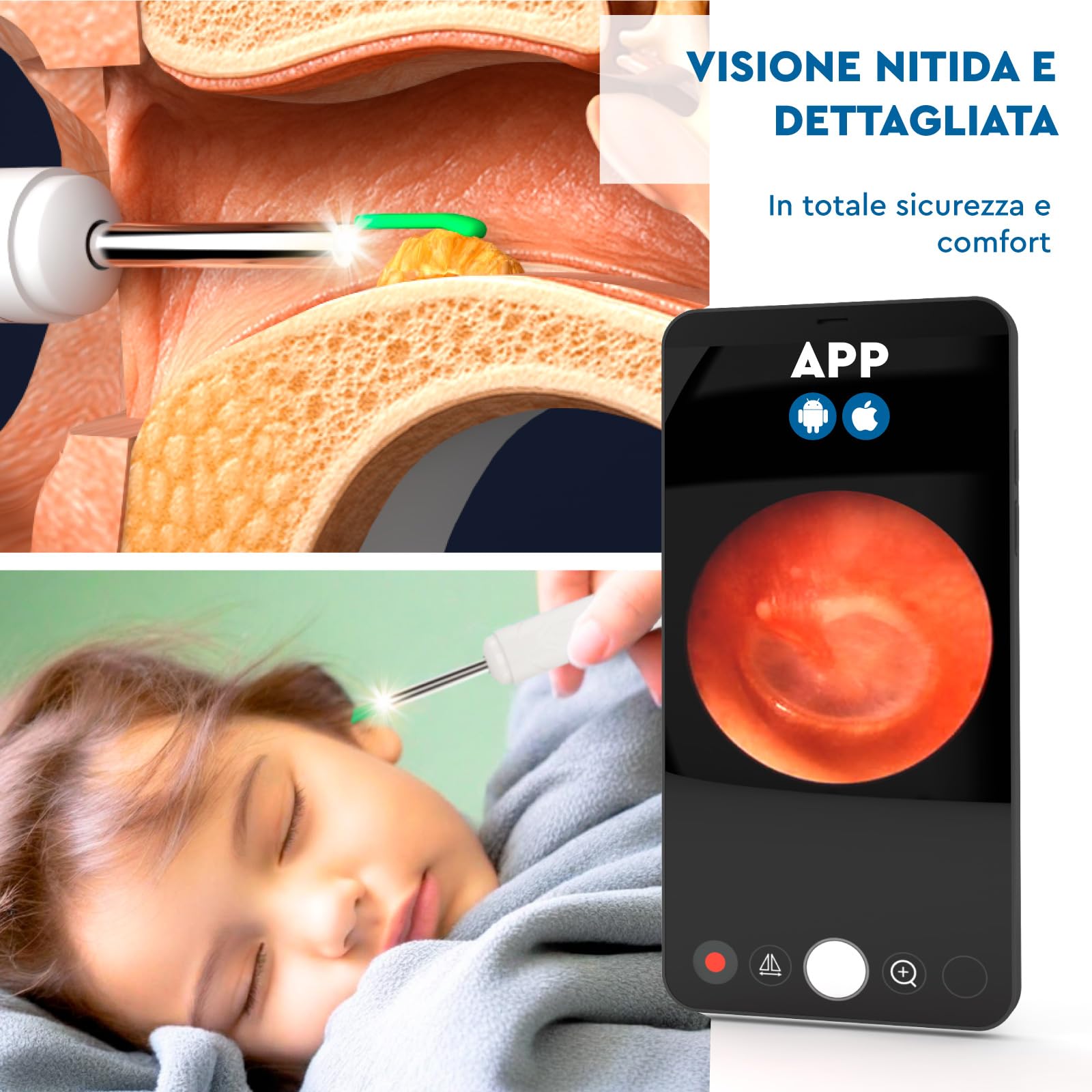 Otoscopio Pulizia Orecchie Rimozione Cerume con Telecamera 1920p WiFi 3,6mm - UdiGuard Pulitore Orecchie Digitale con 6 Luci LED Adulti Bambini Animali - Compatibile con Android iPad iPhone Bianco