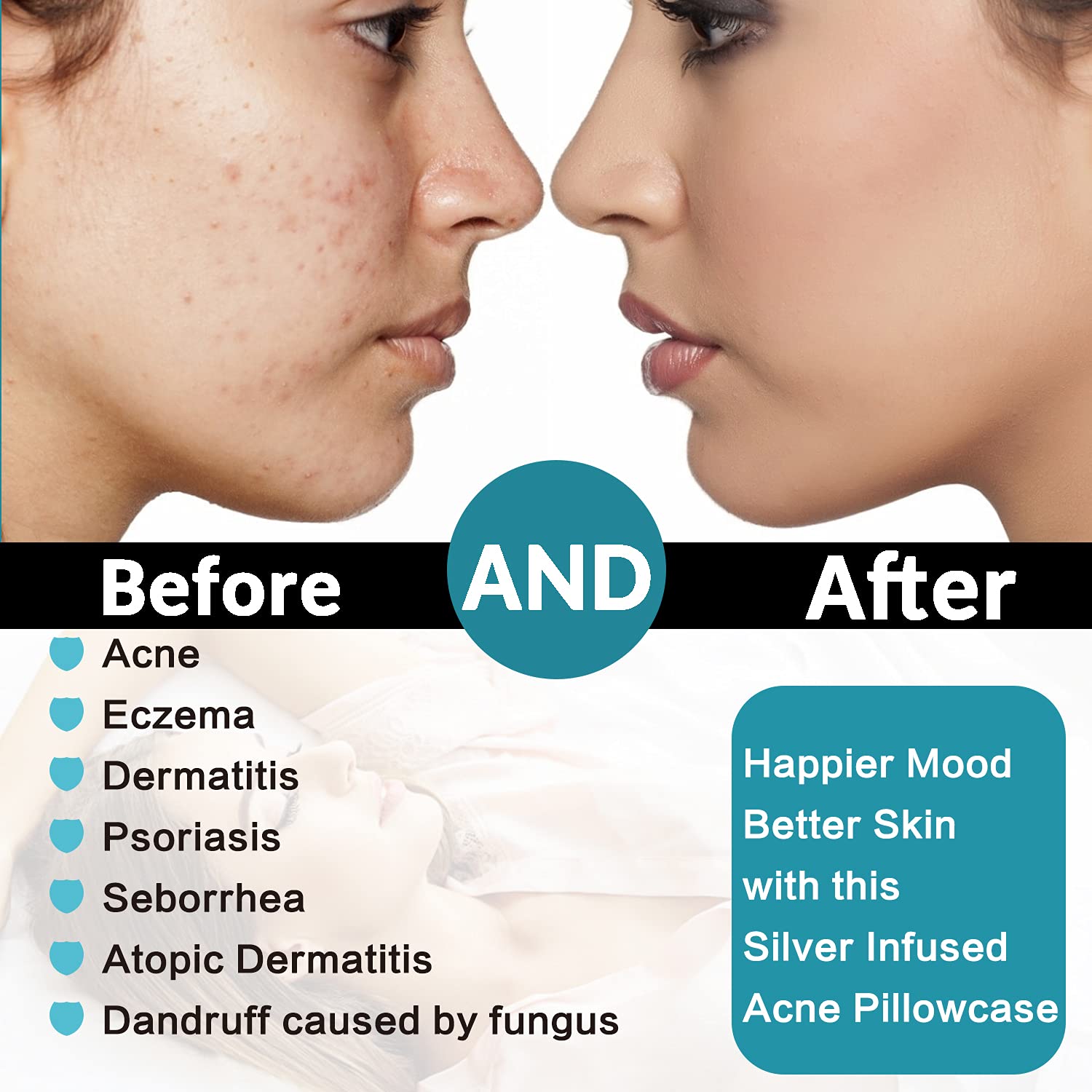 changing pillowcase acne