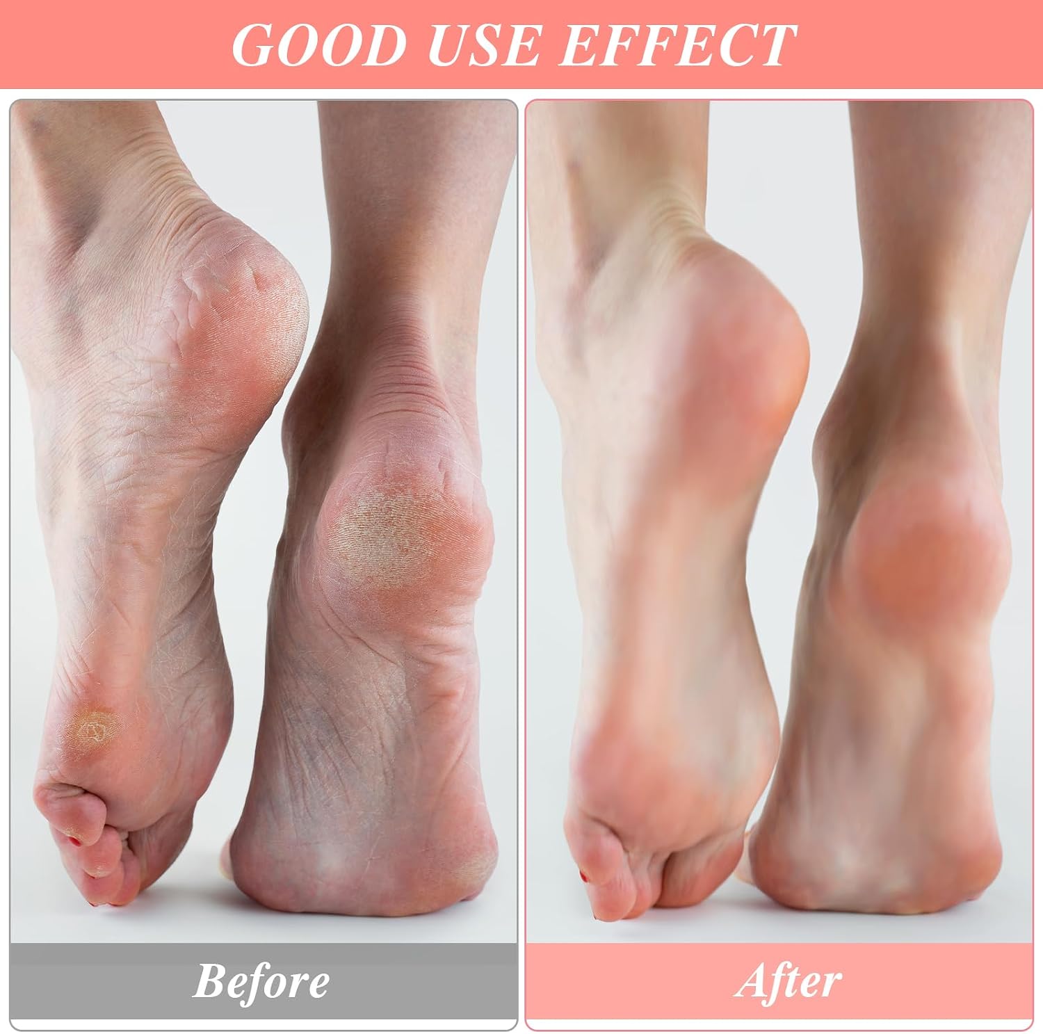 3Pairs Aloe Socks Moisturizing Socks Sleeping SPA Socks for Dry Feet Overnight, Non Slip Coral Fleece Socks for Women, Pedicure Foot Care Socks for Repairing Dry Feet, Cracked Heel