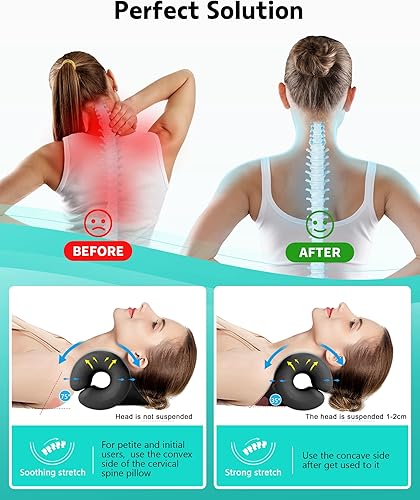 Miniatura 5 de Relajante de cuello y hombros, dispositivo de tracción cervical para aliviar la fatiga y el dolor de cuello y hombros, almohada quiropráctica para