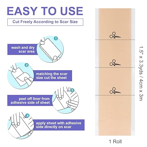 Miniatura 5 de OK TAPE Rollo de cinta de silicona para cicatrices, hojas de silicona para cicatrices, tiras de silicona para cicatrices, reutilizables, hojas