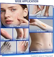 Vista 3 de MasterMo Rollo hidrocoloide para el cuidado de heridas, vendas hidrocoloides extra grandes de grado médico de 2 pulgadas x 16 pies con autoadhesivo