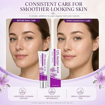 2PCS 12% Azelaic Acid Cream, Gentle and Moisturizing Men Women for Soothing Facial Discomfort