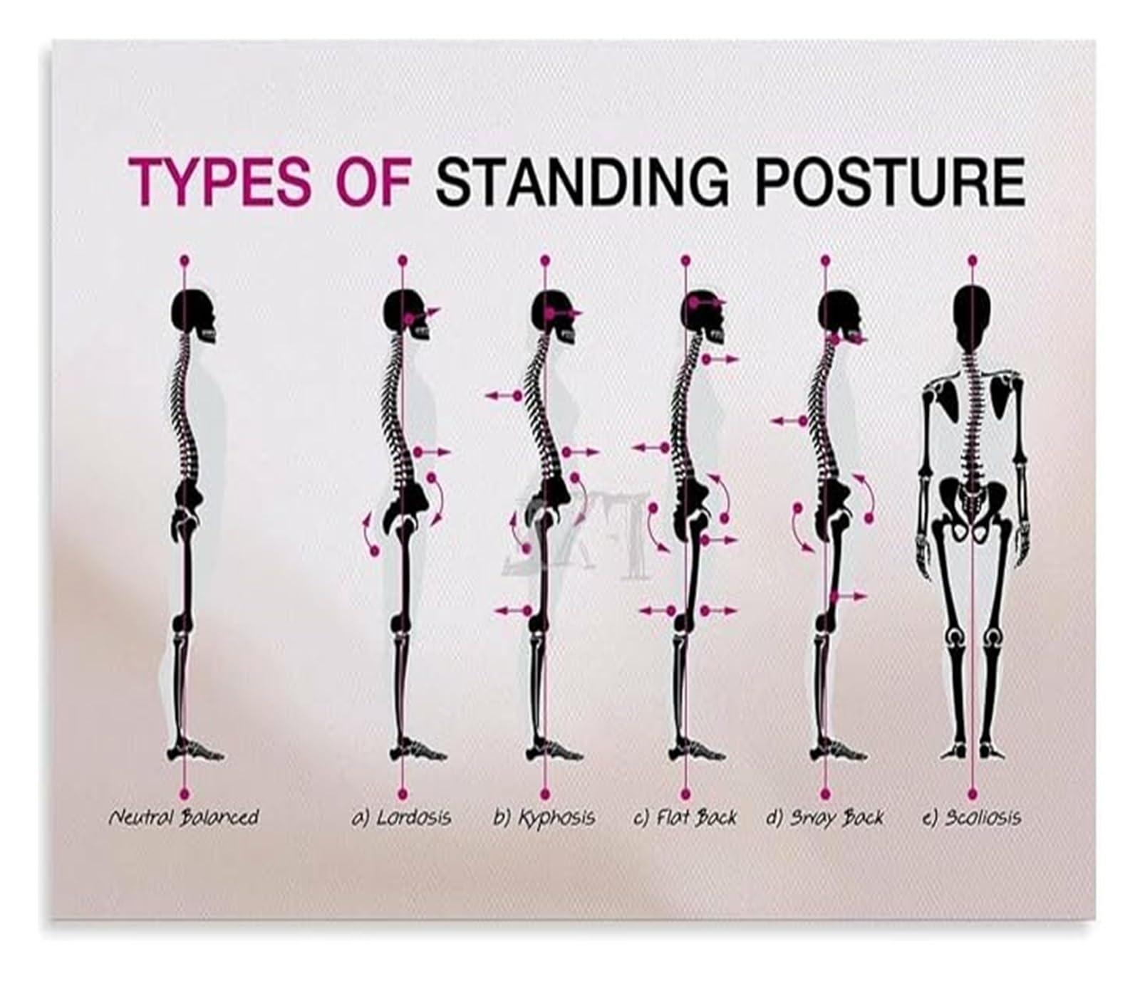 EKFBQBGW Standing Posture Mistakes and Spine Disorders Poster Ergonomic Tips for Desk Workers Home Office Decor