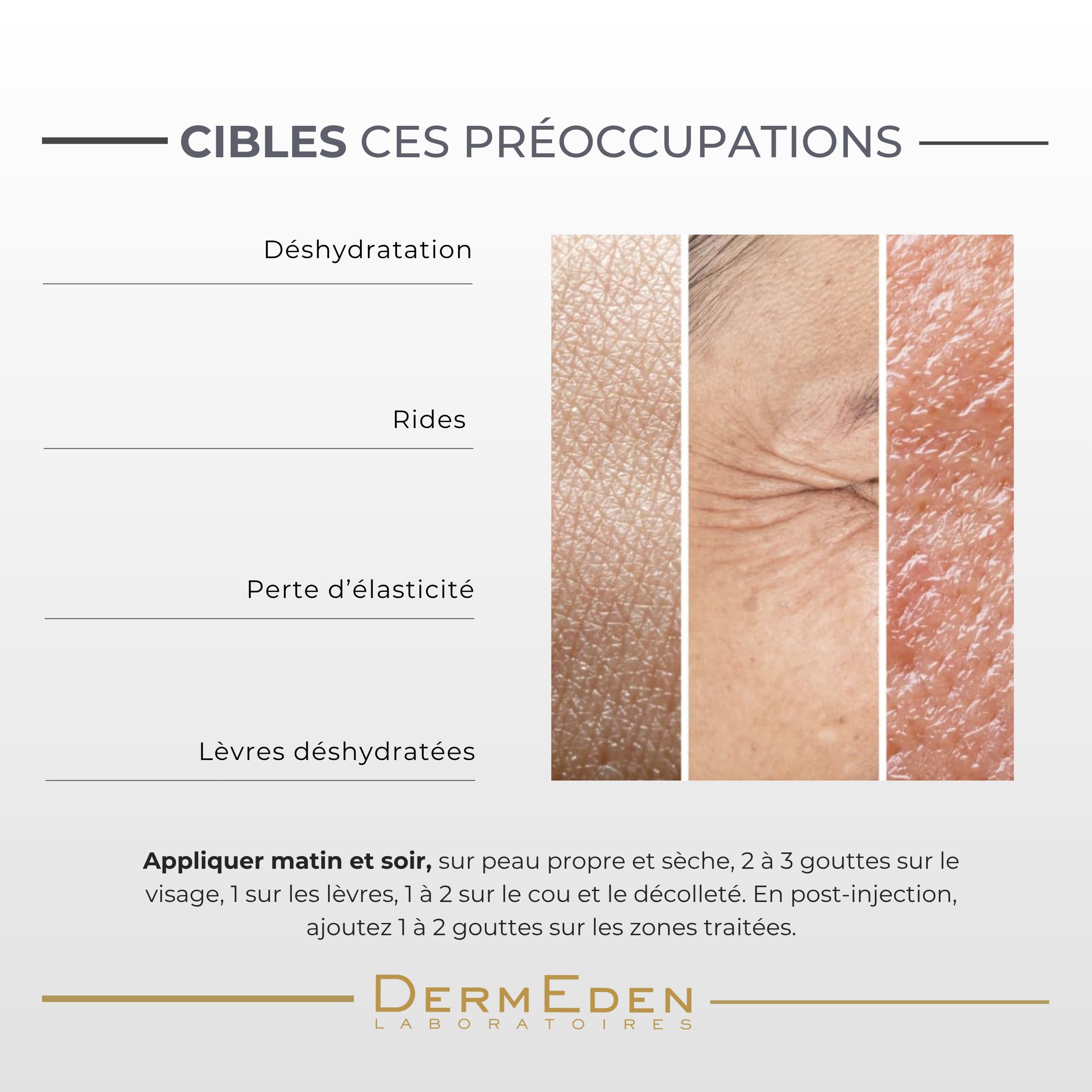 Laboratoires DermEden - Concentré Repulpant et Hydratant 30 ml - Réduit les rides, Améliore l'hydratation et Stimule le collagène - Effet Filler visible dès 30 min - Fabrication Française