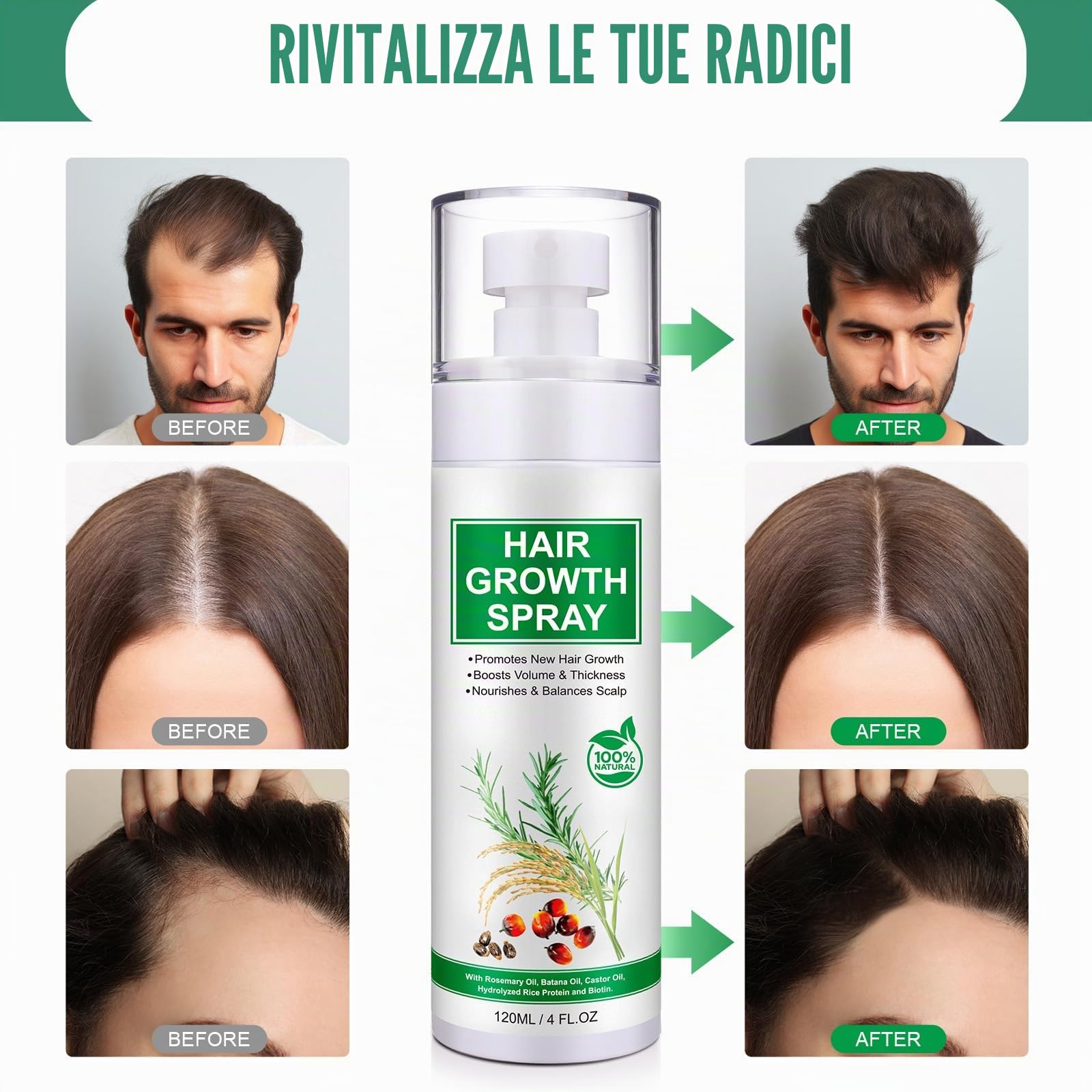 Spray di siero per la crescita dei capelli, olio naturale per la crescita dei capelli con olio biologico di rosmarino, olio di ricino, olio Batana e biotina, crescita dei capelli più sottili