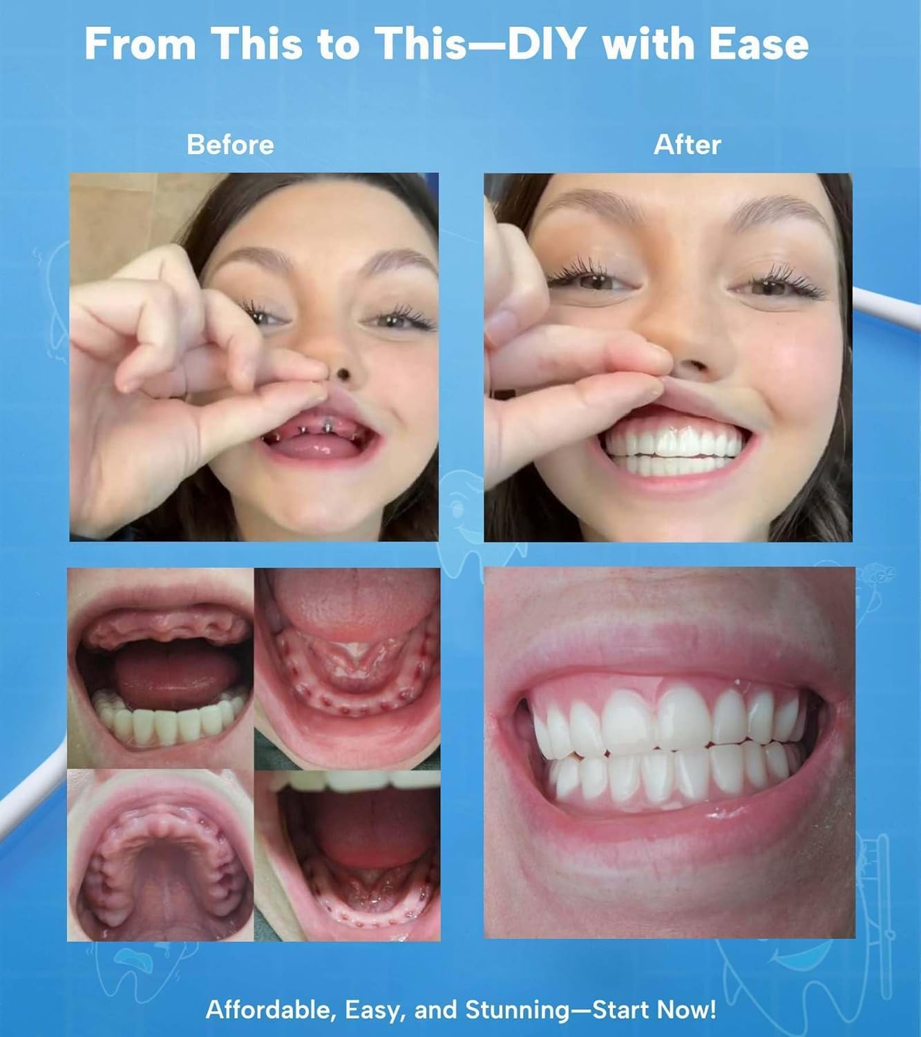 Kit per l'igiene orale fai da te, 2 set completi di denti, 3