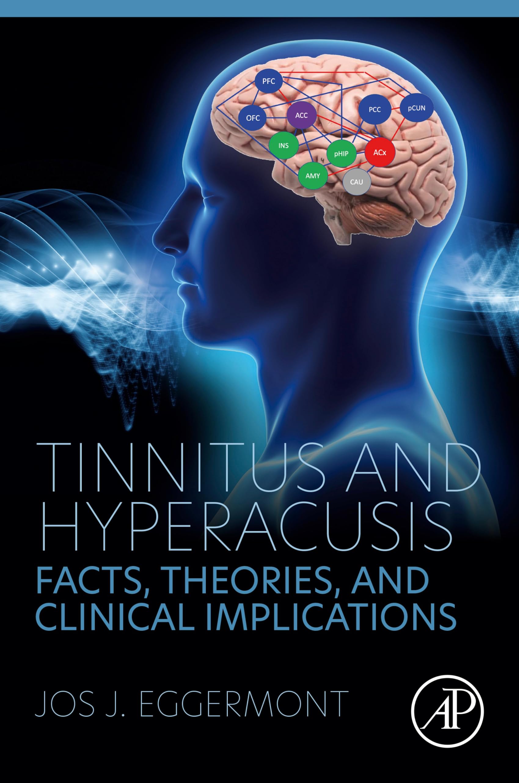 Tinnitus and Hyperacusis: Facts, Theories, and Clinical Implications (English Edition)