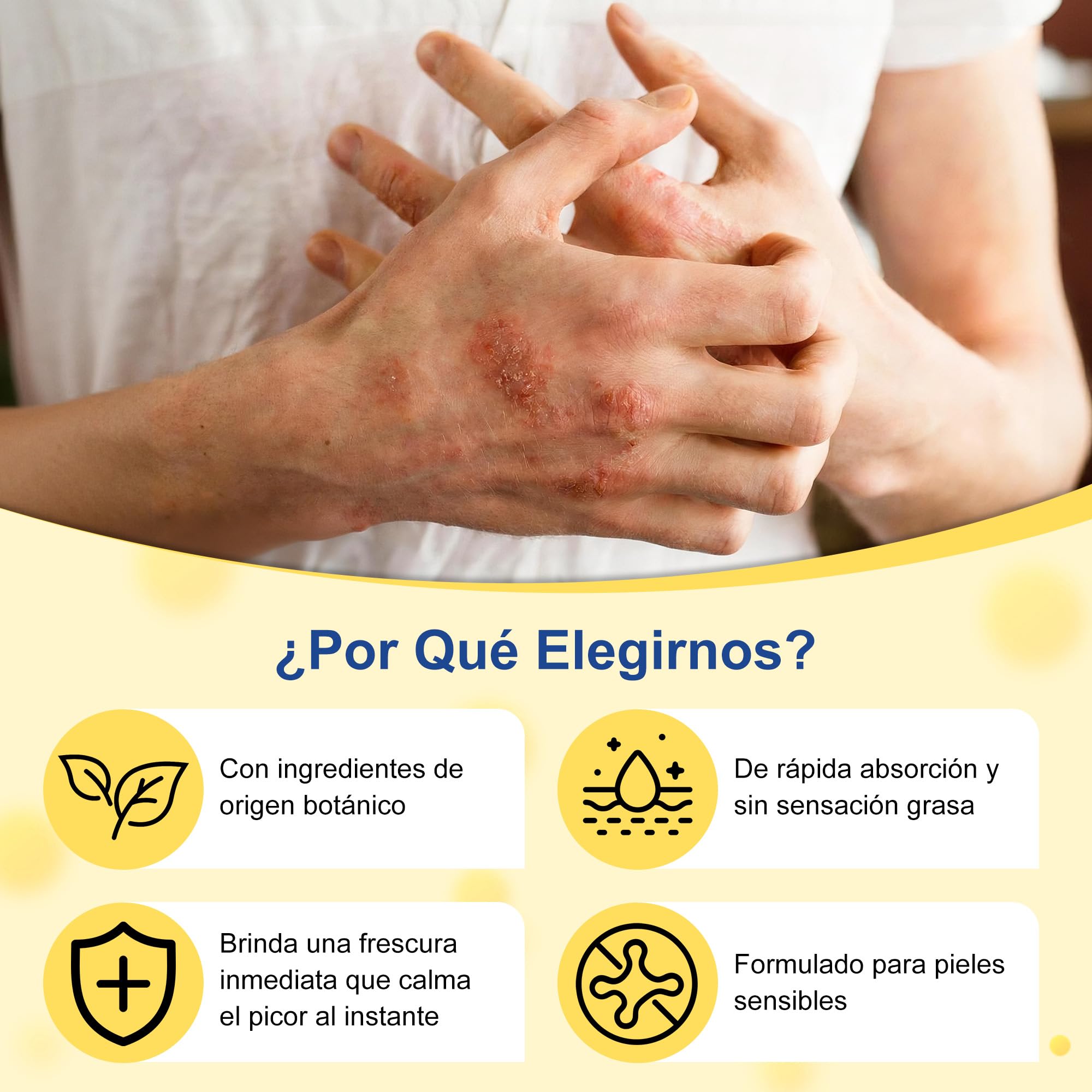 Crema para la Psoriasis,Crema Antipruriginosa 20g,Alivio del Picor y la Descamación,Cuidado Corporal para Pieles Muy Secas y Sensibles - 2