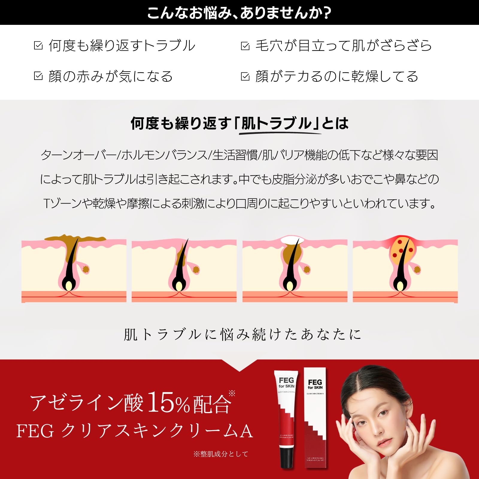 Amazon | FEG アゼライン酸 15%配合 クリアスキンクリームA CLEAR SKIN