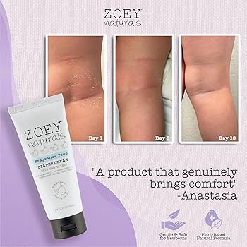 Amazon.com: Zoey Naturals Baby Diaper Cream - Pediatrician