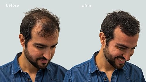 Miniatura 5 de MAXX PRO-SERIES Fibras capilares voluminizadoras con queratina real para adelgazar el cabellopérdida de cabello  Dermatológicamente probado y