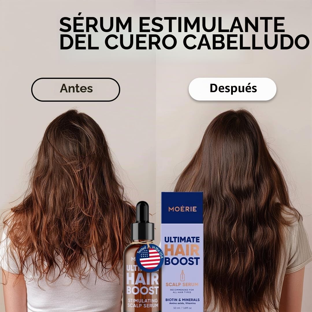 MOERIE serum anticaída y serum crecimiento cabello - Tratamiento anticaída para el cabello delgado - Alternativa al hair oil y el aceite capilar para crecimiento cabello - efectivo y natural - 50ml