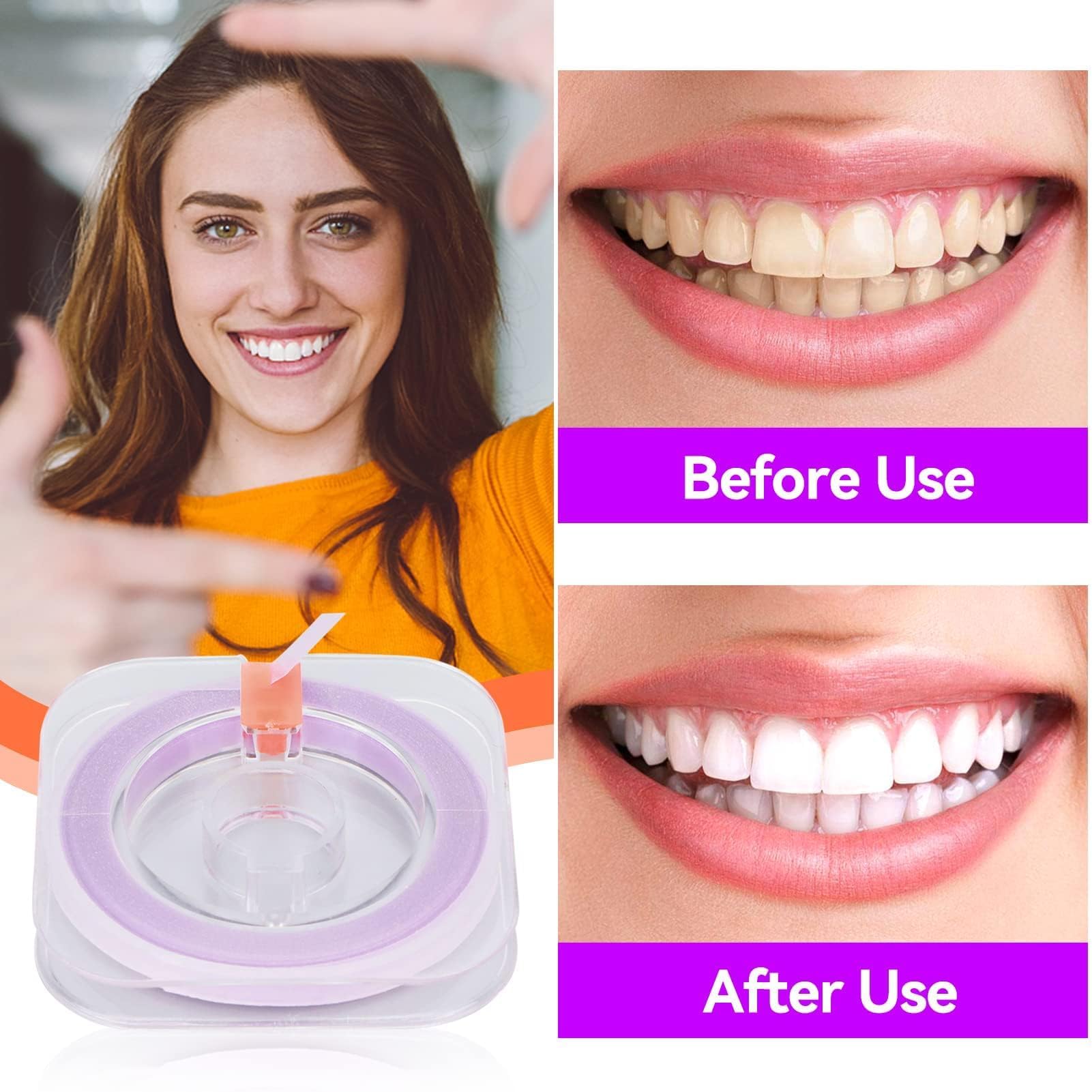 Tiras Dentales Pulidoras Doble Cara 50um Papel De Lija Dental Herramienta De Cuidado Oral