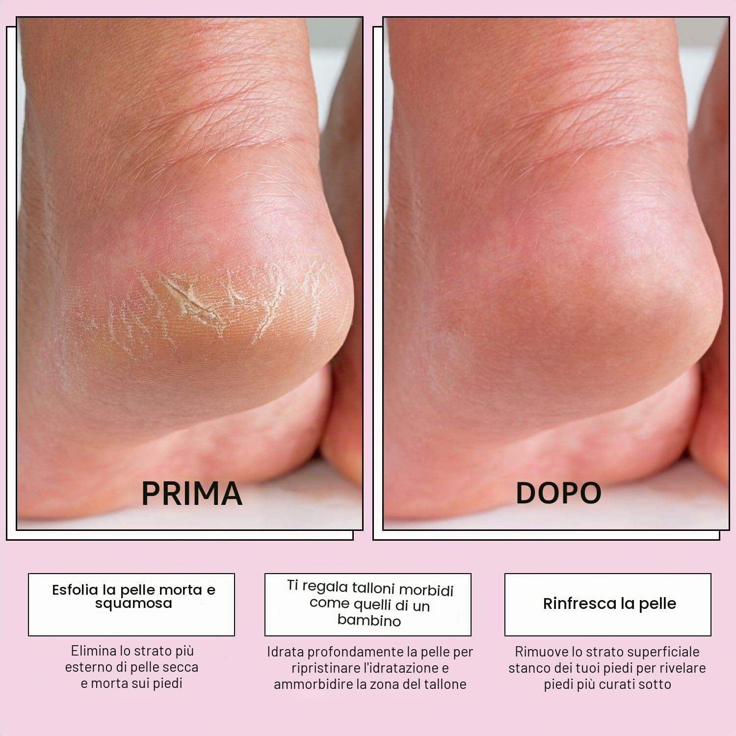 Maschera Piedi Esfoliante (4 Paia, Senza Profumo) – Scrub Piedi con Aloe Vera – Peeling Piedi e Talloni per Rimuovere la Pelle Morta, Calli e Duroni - (4 Pairs)