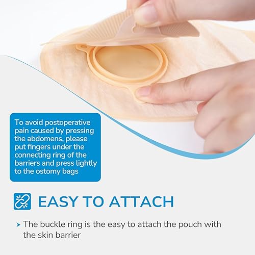 Miniatura 4 de 15 bolsas de colostomía de 2 piezas, suministros de colostomía, bolsas de ostomía convexas de 1.772 in de profundidad para estomas retraídos, bolsa