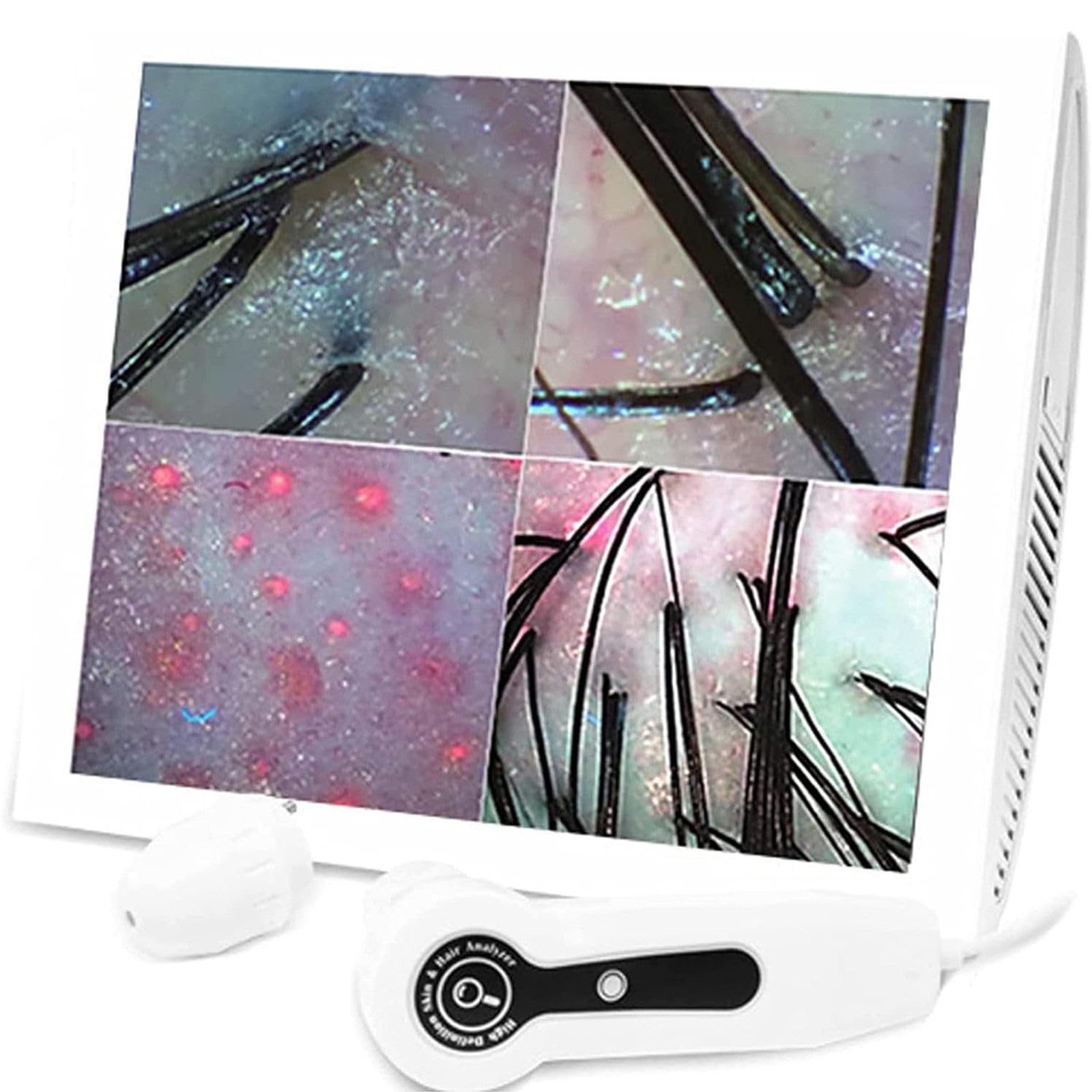 Microscope professionnel 70x 200x pour analyse de peau et follicule