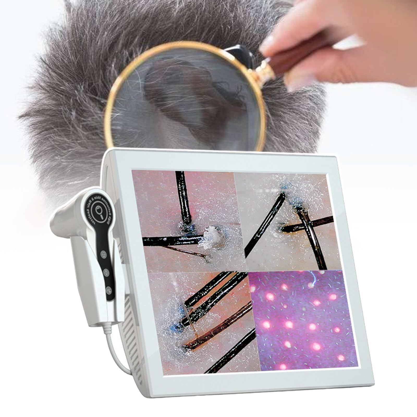 Haut-Haar-Kopfhaut-Detektor, Mit 15-Zoll-Bildschirm, Wiederaufladbares Kopfhaut-AnalysegeräT, Mit Bildspeicherfunktion,220V