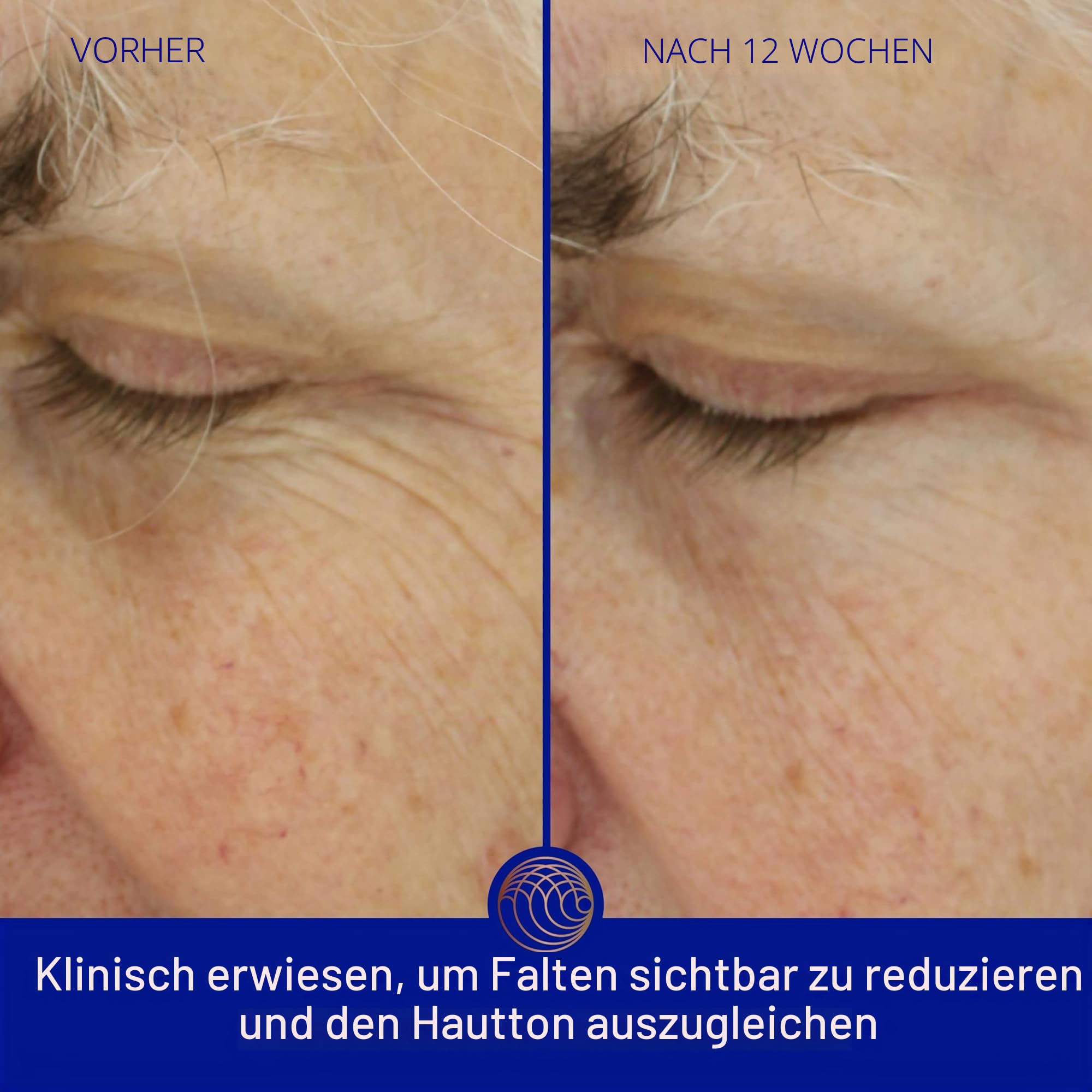 Augustinus Bader The Light Cream (30ml)