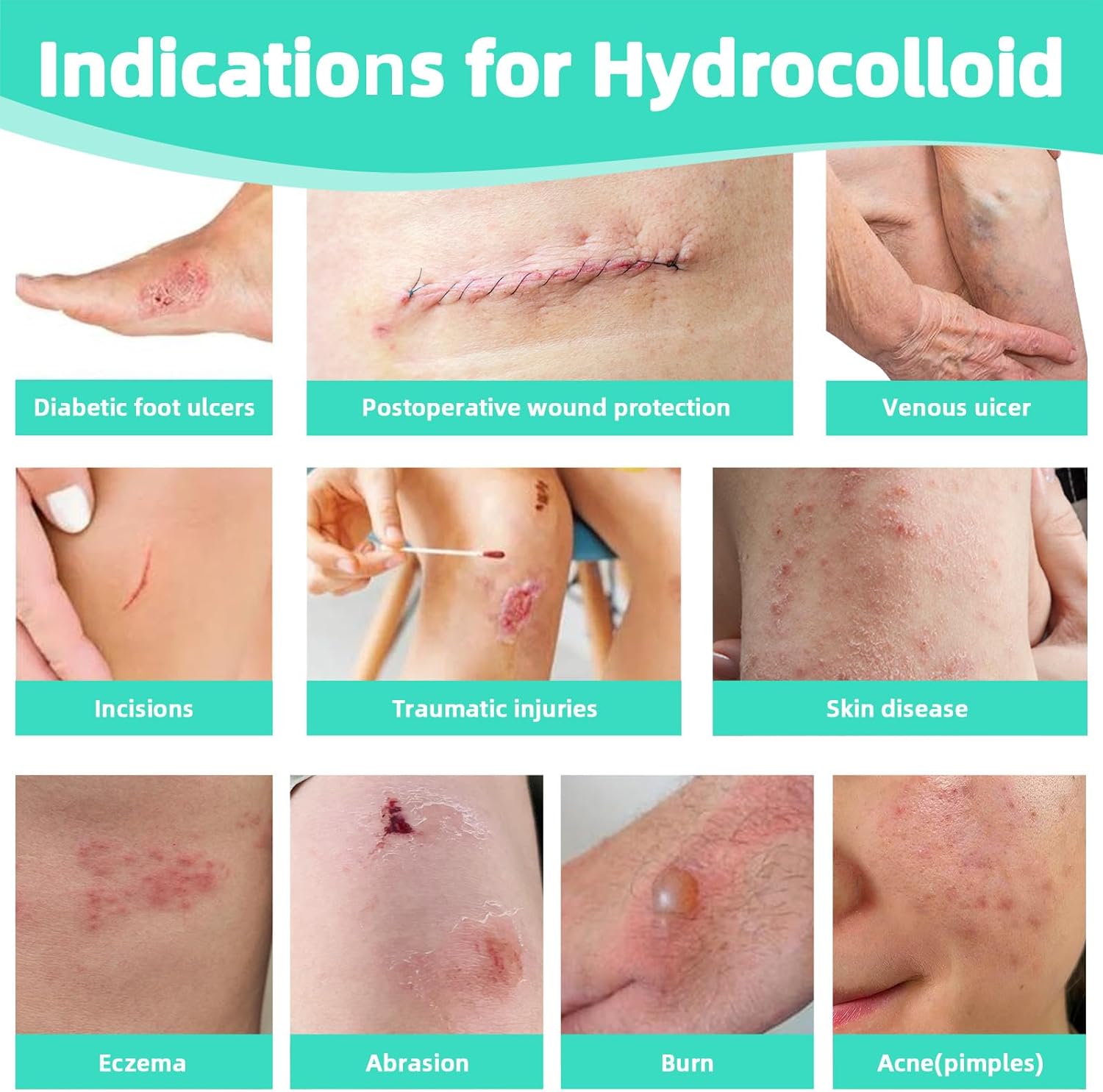 Hydrocolloid Roll for Wound Care - Cut-to-Size Extra Large Hydrocolloid Patch Bandages, Waterproof, Ultra Absorbent & Flexible, First Aid Kit Essential!