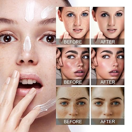 Miniatura 2 de Crema para Manchas Oscuras en La Cara, Cremas para Quitar Manchas de La Cara, Crema Blanqueadora para Pecas, Elimina el Melasma Manchas Oscuras