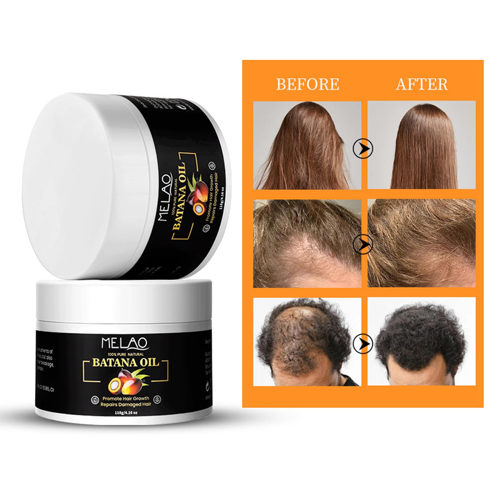 Raw Batana Oil for Hair Growth 100% Organic Pure Dr. Sebi Botana Oil, Repairs Damaged Hair Prevents Hair Loss - Image 3