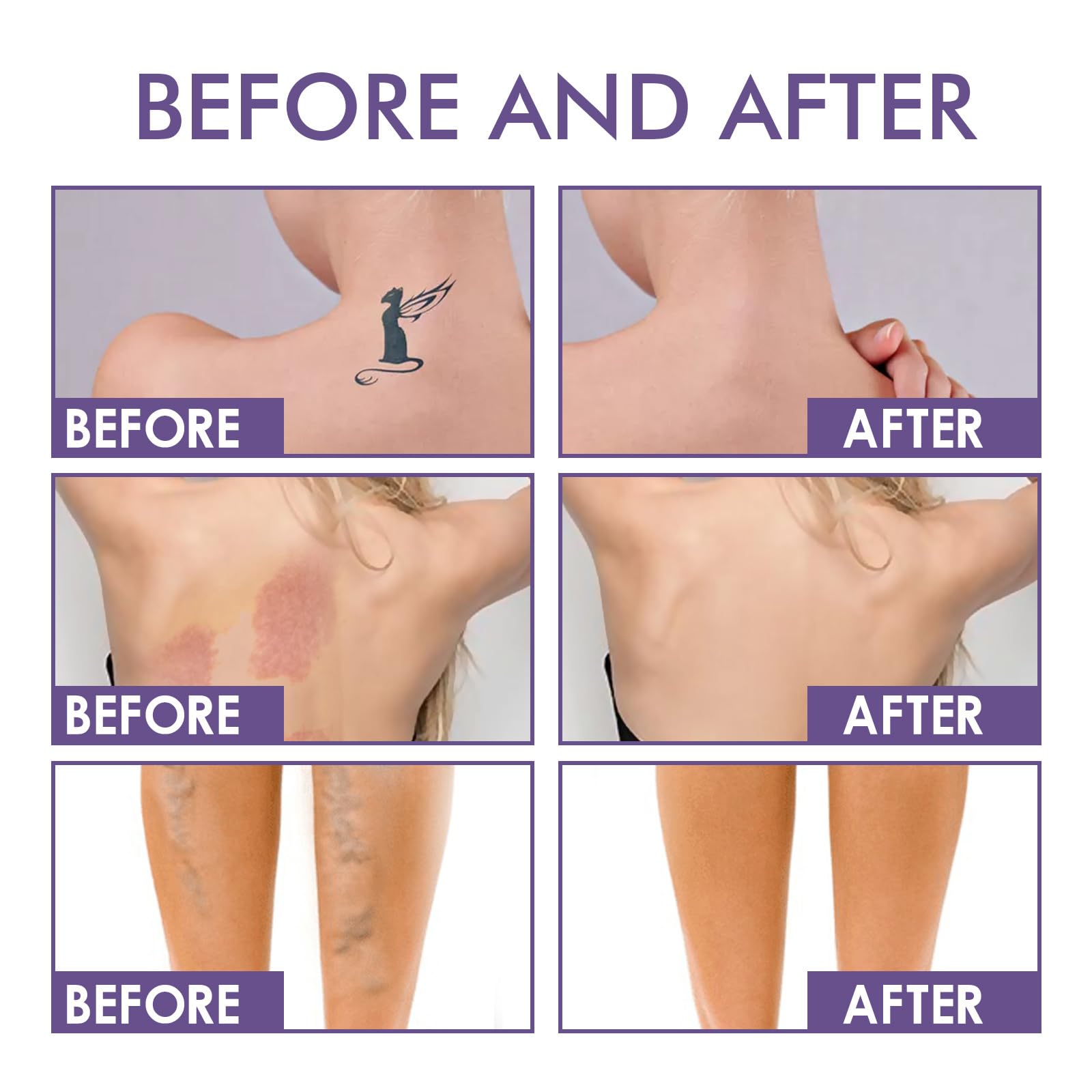 Coverage Perfector for Legs & Areas Concealing Tattoos Scars & Blemishes - Image 2