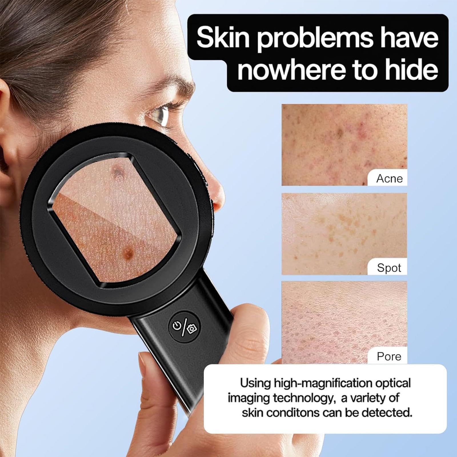 Microscopio Digital de Dermatoscopio de Mano, Analizador de Piel y Cuero Cabelludo Digital 100x con Cámara de 16MP, Pantalla LCD de 2 "para Folículo Piloso, Poro, Inspección de Cabeza Negra