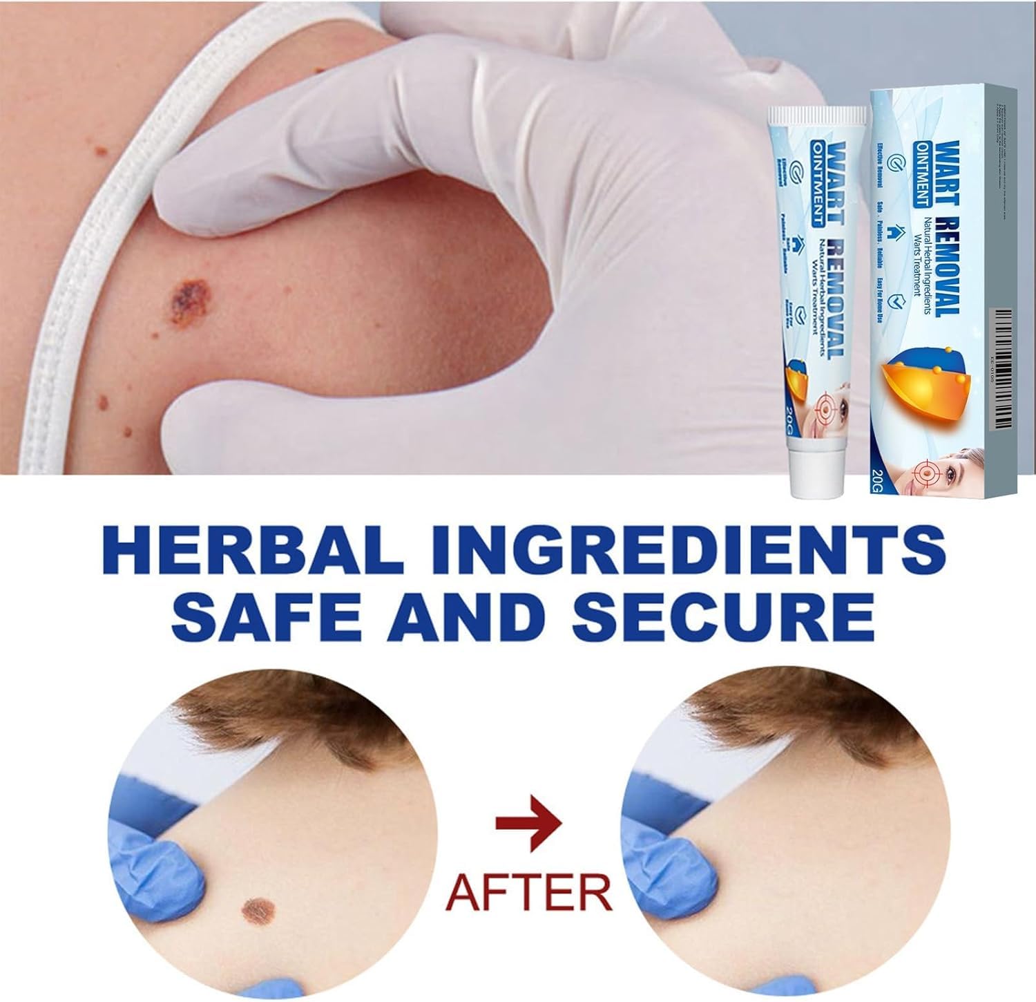Fibromi Penduli Rimozione,Verruche Rimozione,Crema Per Eliminare Fibromi Penduli,Wart Removal Fibromo Pendulo Rimoziones,Crema Levigante Viso Corpo Mani Piedi (20g 3pcs) - 2