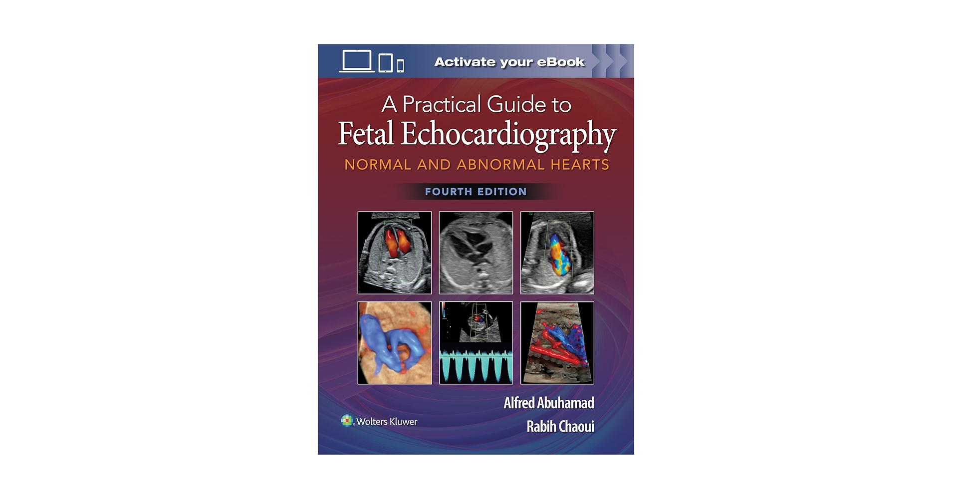 健康・医学 A Practical Guide to Fetal A Practical Guide to Fetal Echocardiography: Normal and