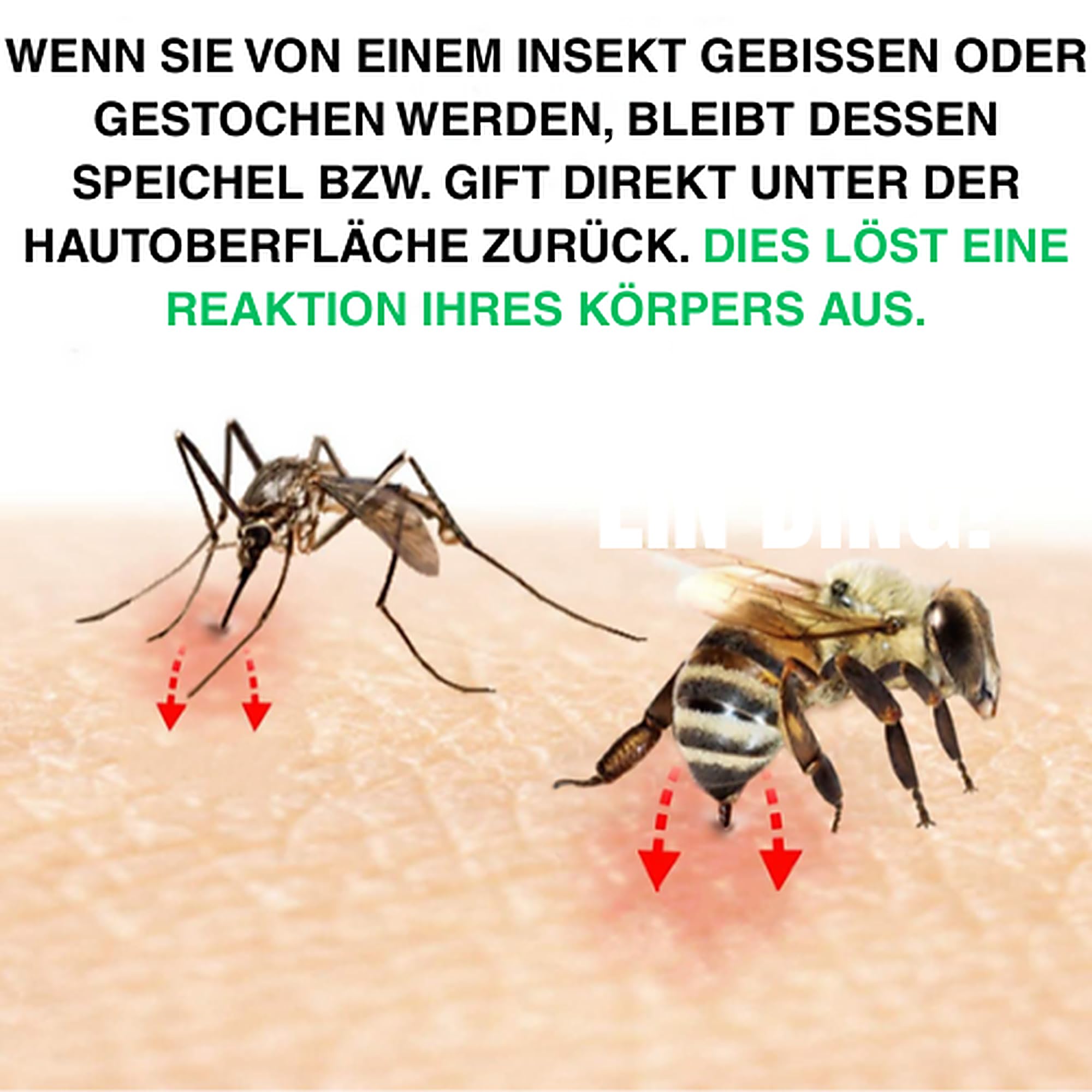 BUG BITE THING Suction Tool Mosquito/Insect Bite Sting, Chemical Free, Made in Denmark - White (BBT0001) 1
