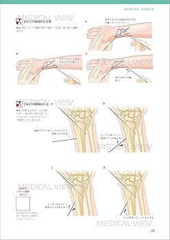 新OS NEXUS No.15 小児の骨折と手術 メジカルビュー社｜整形外科｜新OS NEXUS No.15 小児の骨折と