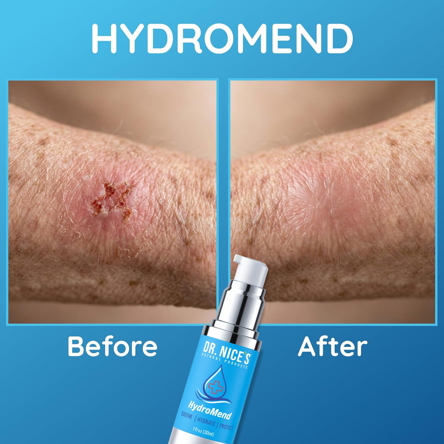 DR. NICE'S HydroMend Hydrogel Wound Gel for Seniors - First Aid Skin Repair Gel for Minor Cuts, Scrapes, Sores & Burns on Thin, Fragile & Aging Skin - Soothing Protective Barrier - USA Made, 1 Fl Oz — Amazon image 5