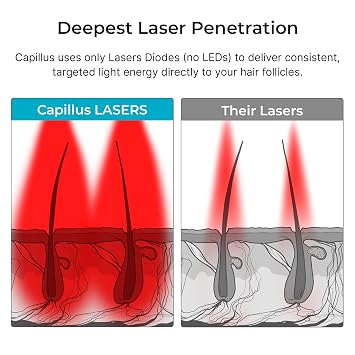 Capillus Pro S1 Red Light Therapy for Hair Growth Hair Red Light Therapy Red Light Cap for Hair Regrowth, 304 Laser Cap for Hair Regrowth Red Light Hair Therapy Laser Hair Growth Cap
