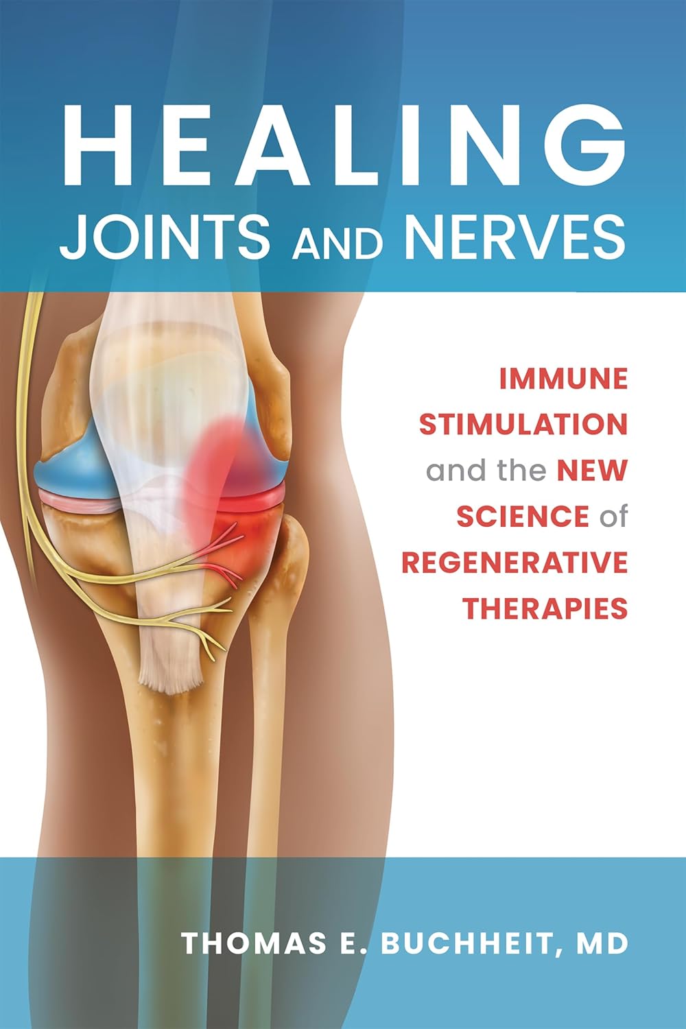 Healing Joints and Nerves: Immune Stimulation and the New Science of Regenerative Therapies      Paperback – January 13, 2026