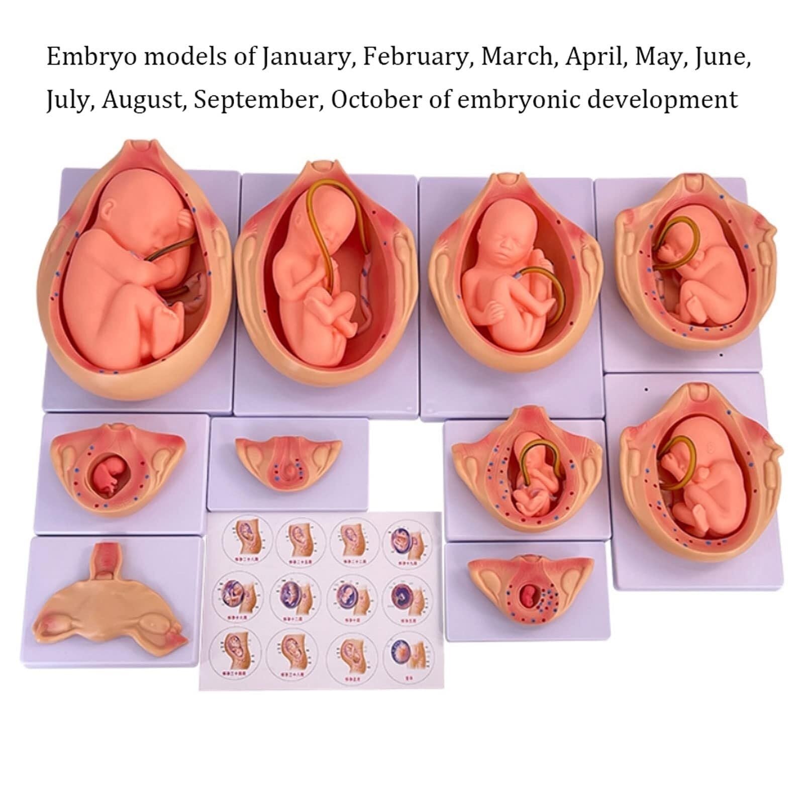 Modelo de proceso de desarrollo fetal – 10 piezas de equipo médico anatómico de estudio de embriones para anatomía uterina y educación médica