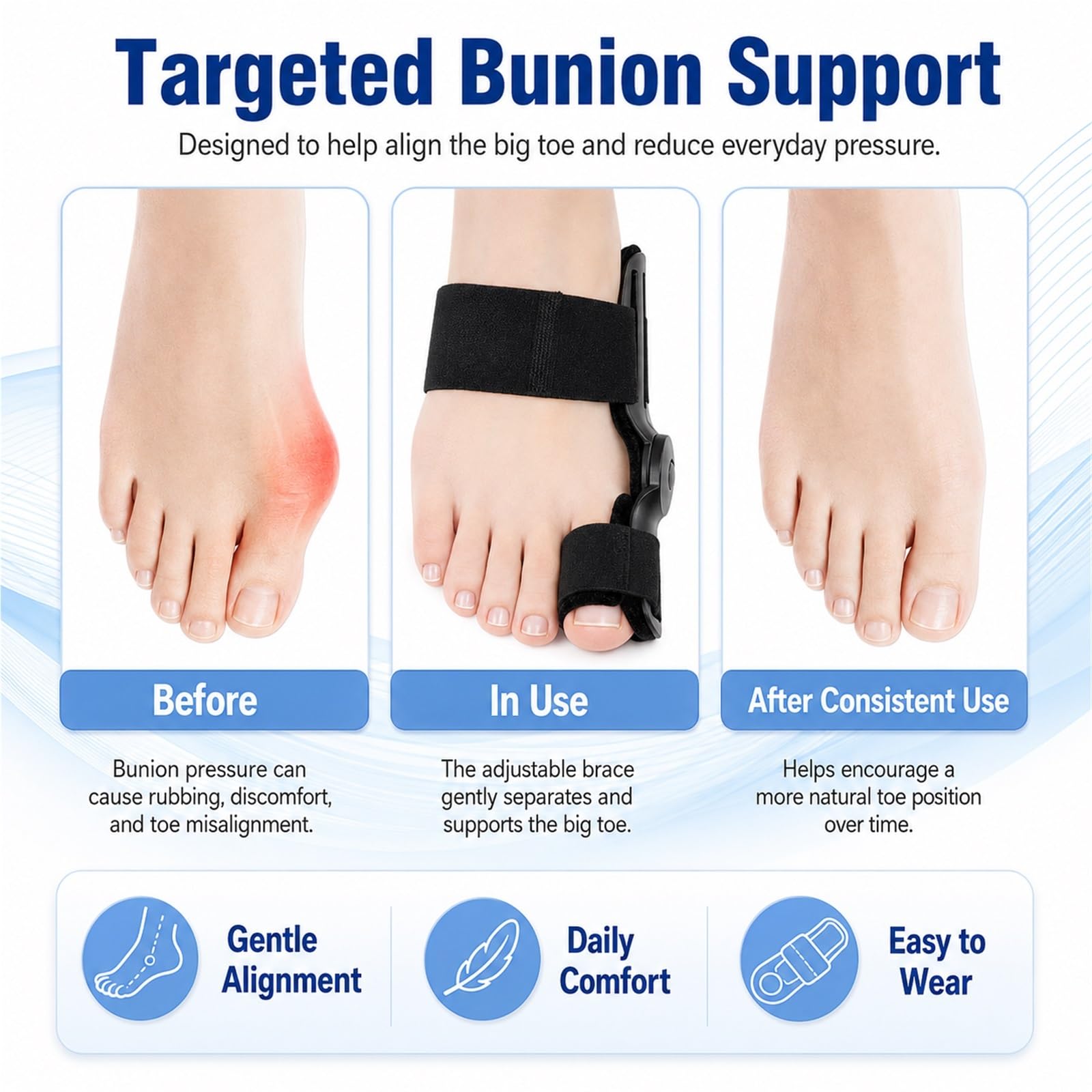 Hallux Valgus Korrektur Schiene Damen Herren, Zehentrenner Großer Zeh mit Verstellbarem Knopf, Orthopädische Zehenkorrektur Orthese zur Schmerzlinderung, Universal