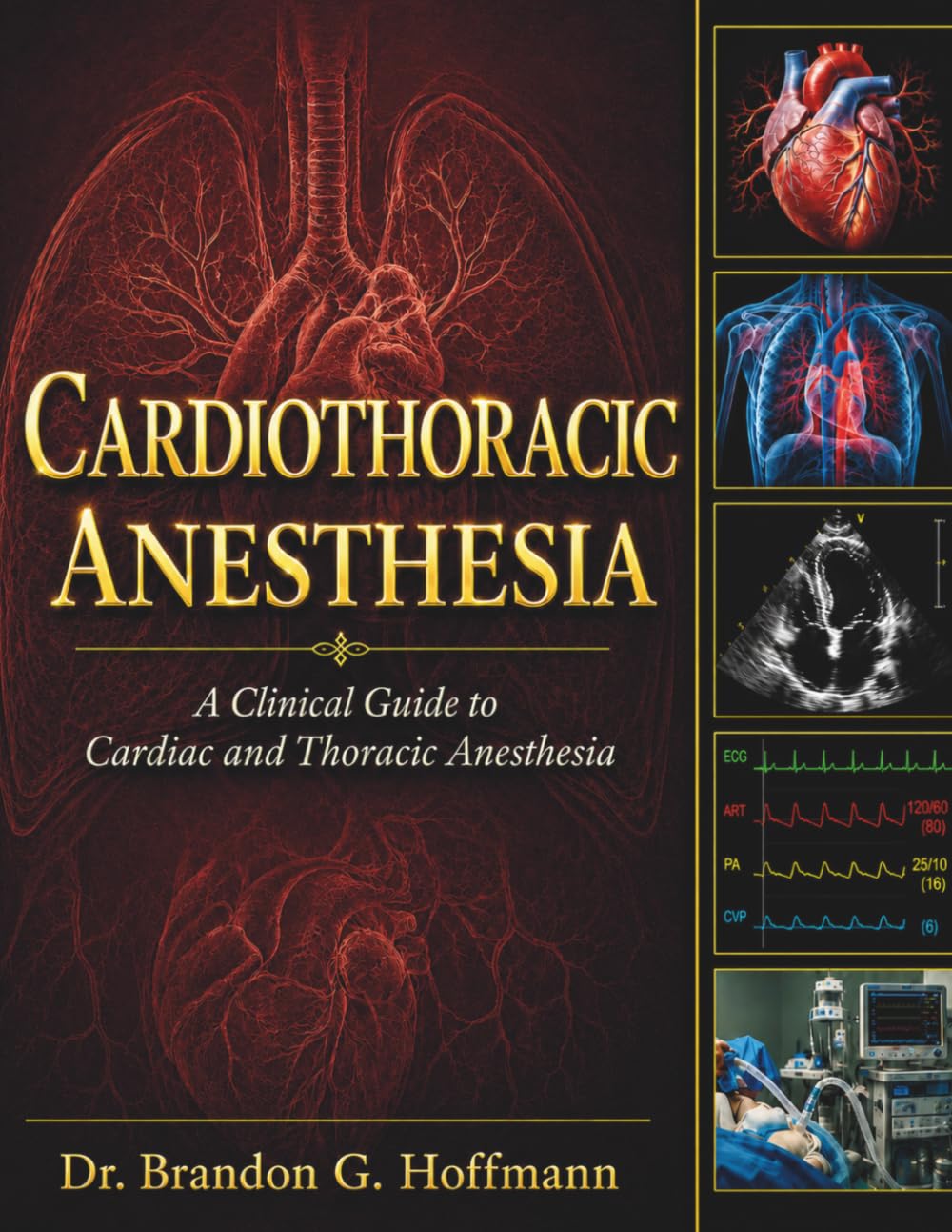 Cardiothoracic Anesthesia: A Clinical Guide to Cardiac and Thoracic Anesthesia