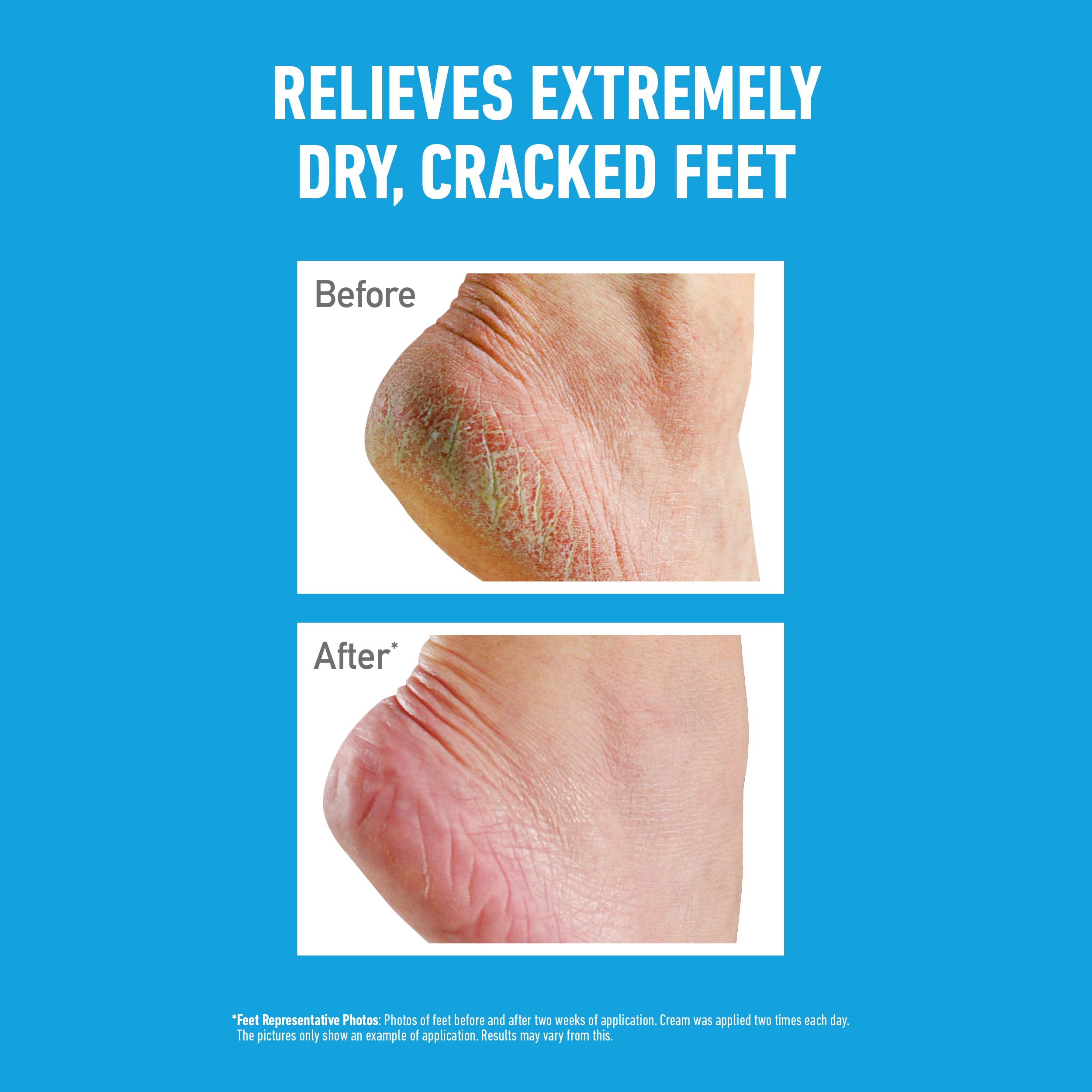 O'Keeffe's Healthy Feet krem do stóp 91 g - 2 sztuki