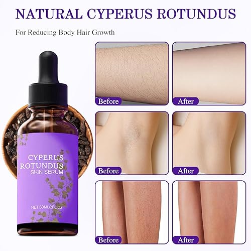 Miniatura 4 de Cyperus Rotundus - Suero para la piel, aceite orgánico natural de Cyperus Rotundus, aceite corporal ligero y relajante, natural calmante y suave (2