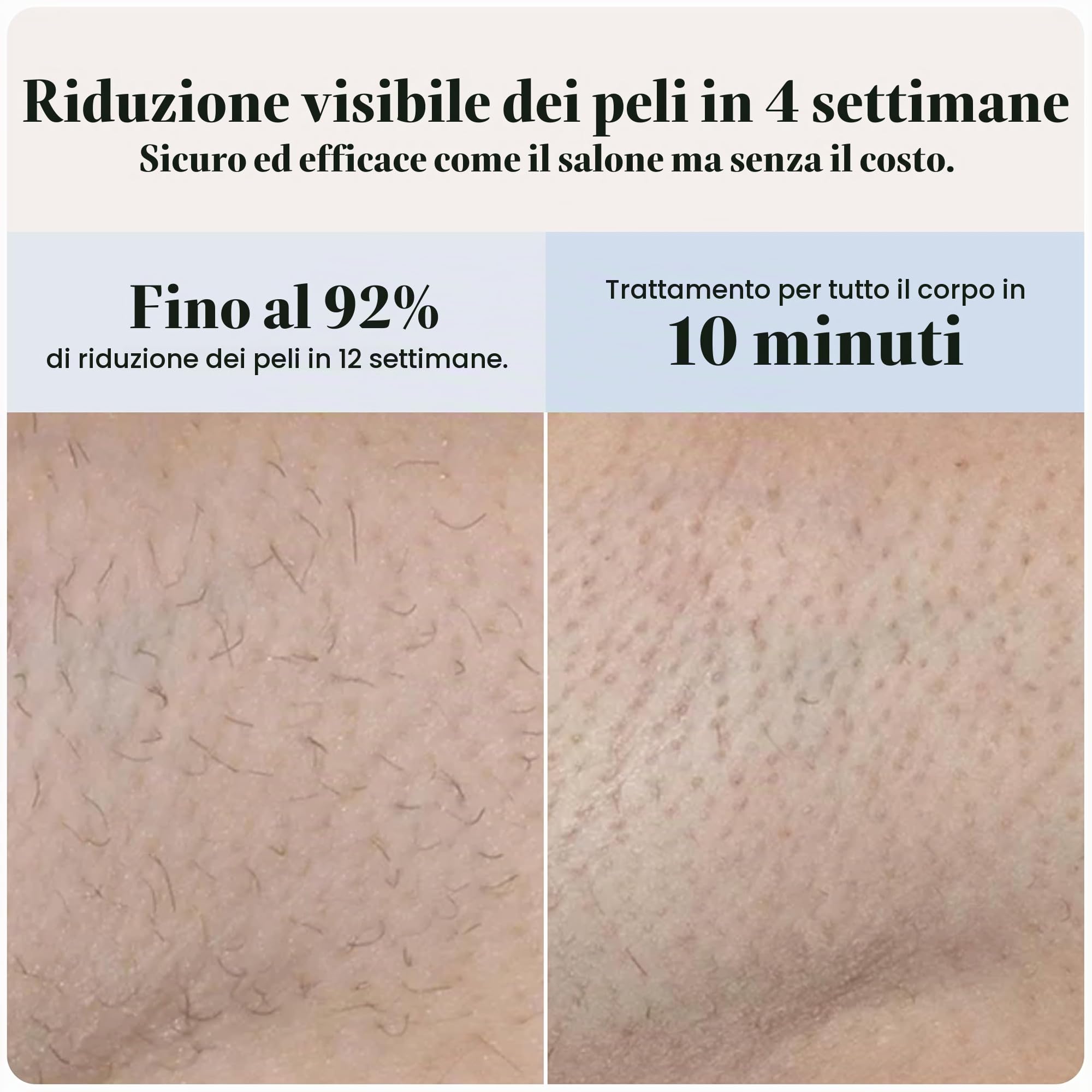 SmoothSkin Dispositivo di depilazione Pure Mini Lite IPL Blue - Depilazione laser compatta a casa per donne, sicuro per viso e corpo, riduzione permanente dei capelli, delicato e indolore, risultati