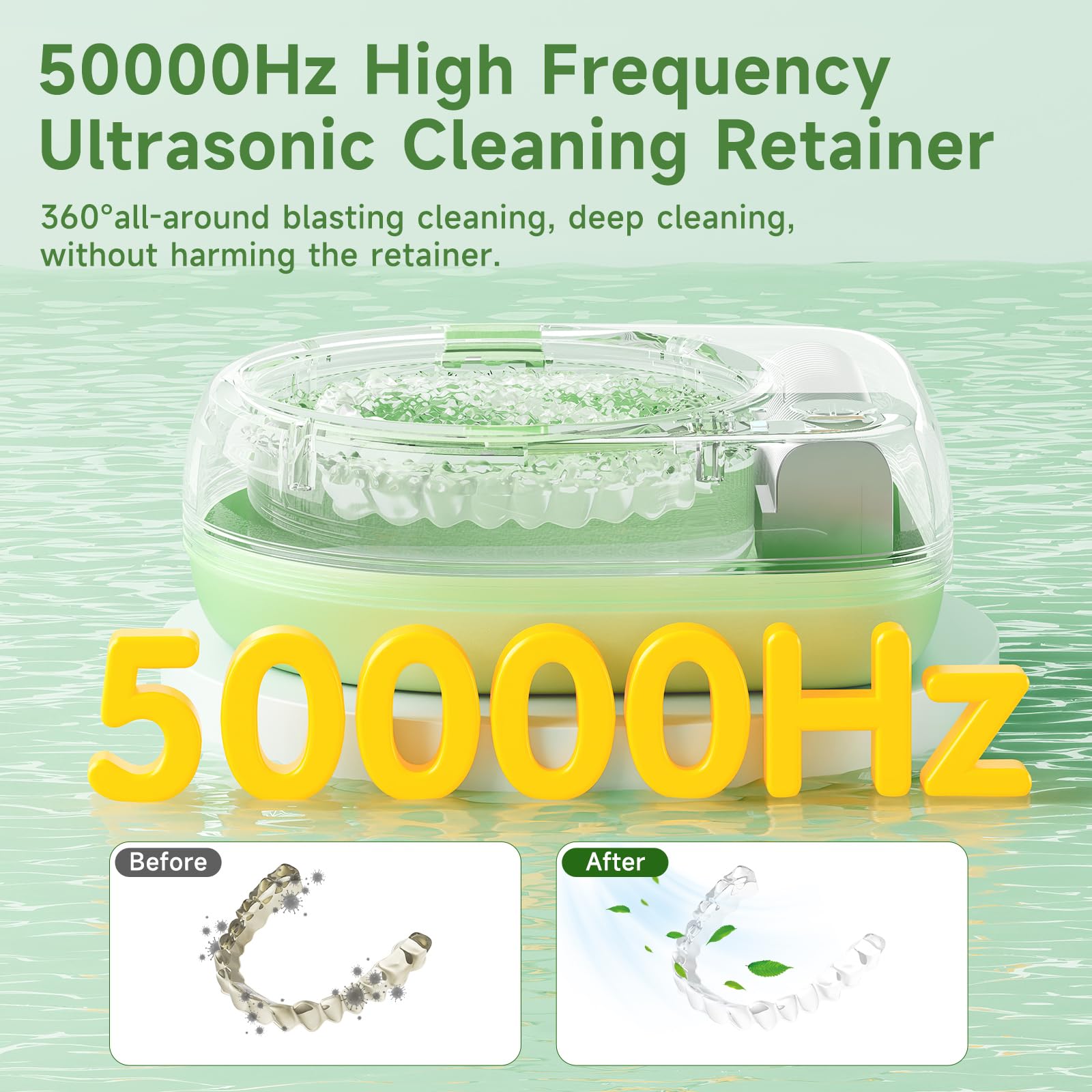 Limpiador de retenedores ultrasónico, recargable, inalámbrico, máquina limpiadora para aparatos ortopédicos, adolescentes, 50 kHz, 2000 mAh, portátil, 2 modos para viajes, escuela (verde)