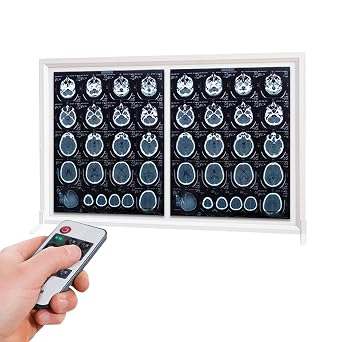 12V LED X-Ray View Box, Wall Slide Viewer Illuminator Light Box, Remote Control Dimming, Flicker-Free, for Hospital X-Film or Ct-Film Lab Equipment30x19"