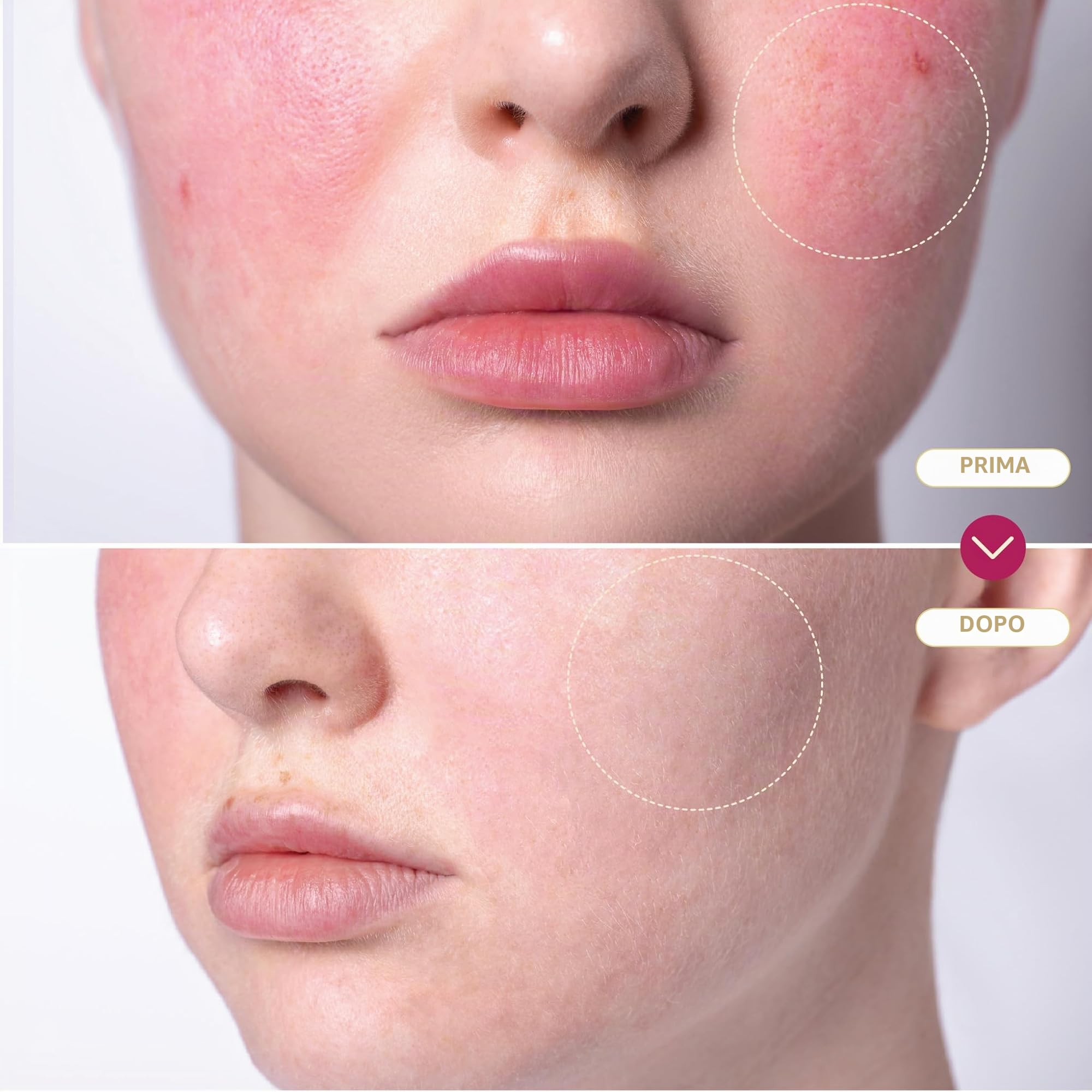 BASE LABORATORIES Spray acido ipocloroso, guarigione della pelle per ferite, soluzione spray per la cura delle ferite, eczema, tatuaggi e piercing | lavaggio delle ferite con soluzione salina
