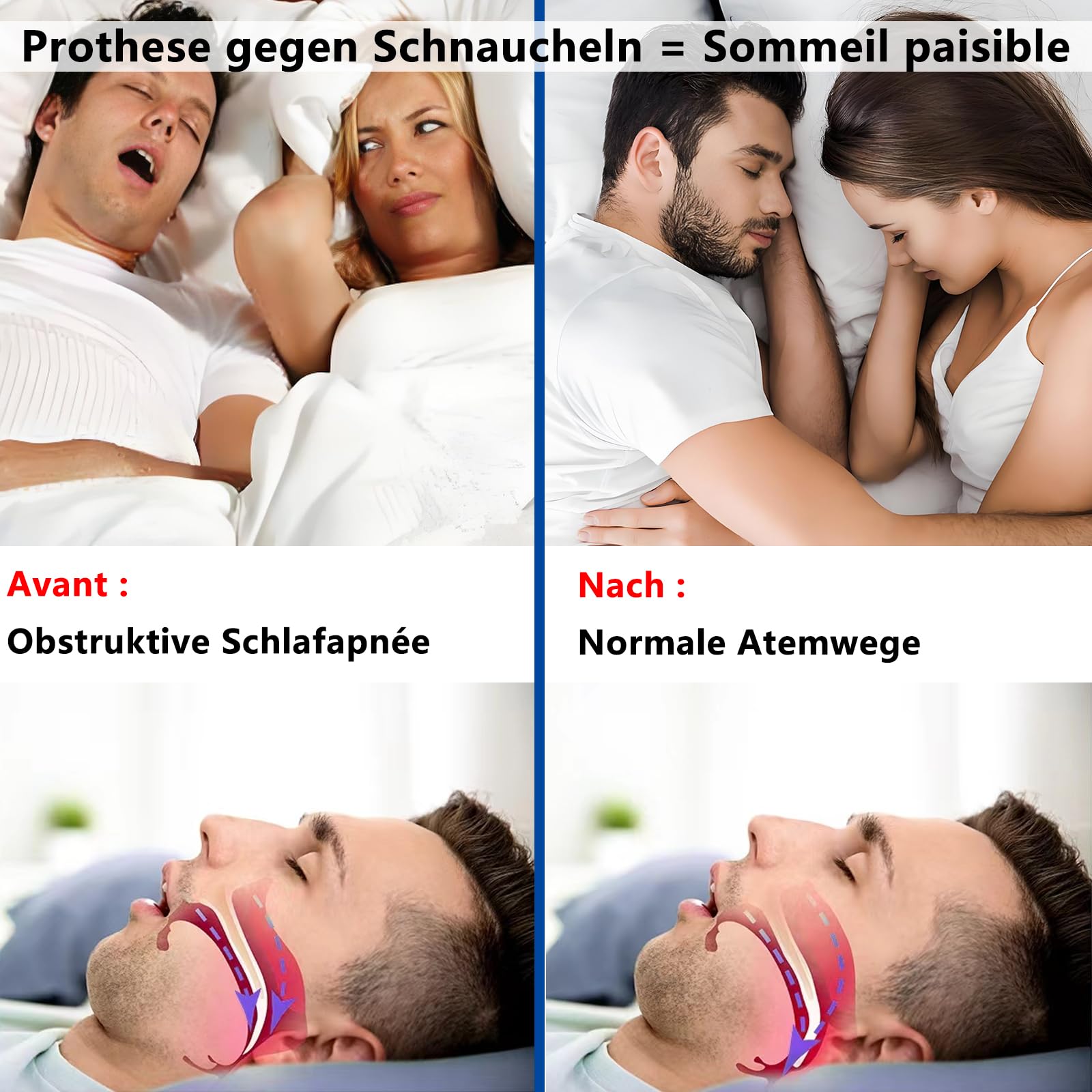 Schnarchschiene Verstellbare Aufbissschiene gegen Schnarchen und Knirschen - Anti Schnarch Schnarchstopper - Anti-Snoring Mouth Guard - Verbessert Schlafqualität (Weiß mittel)