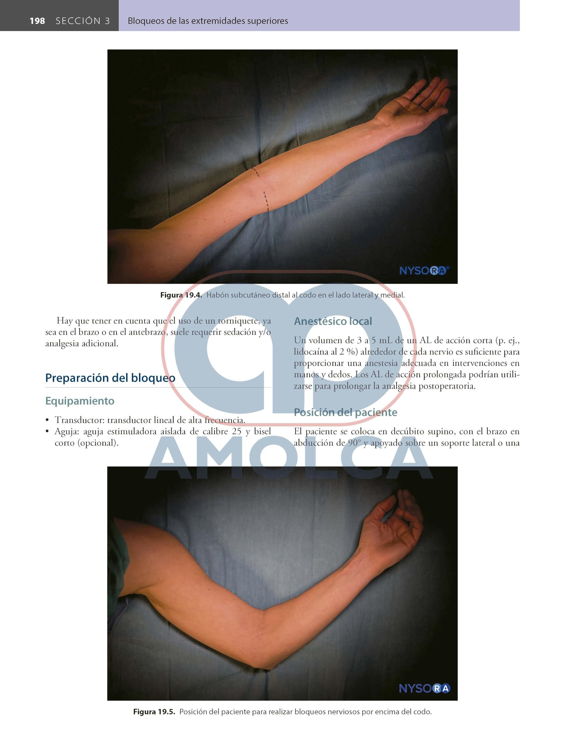 Bloqueos Nerviosos Periféricos y Anatomía para Anestesia Regional Guiada por Ecografía de HADZIC