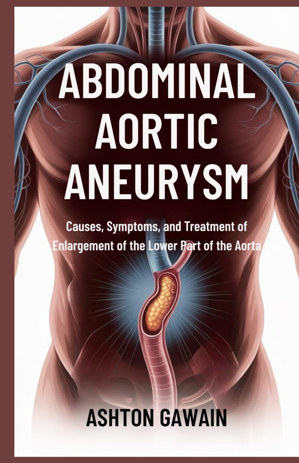 Abdominal Aortic Aneurysm: Causes, Symptoms, and Treatment of Enlargement of the Lower Part of the Aorta