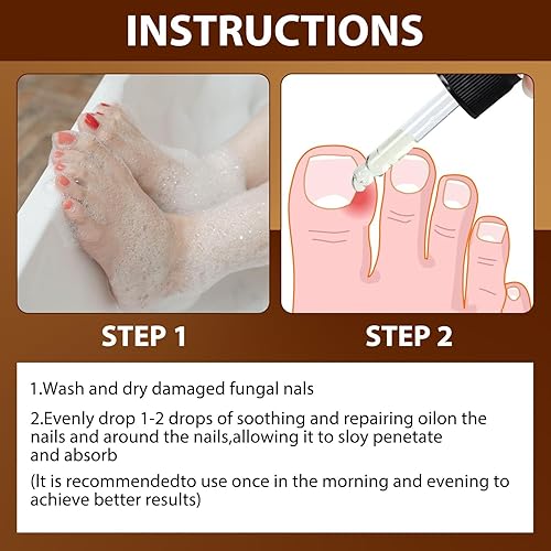 Miniatura 6 de Aceite de enfermería de paroniquia, aceite de alivio antiparoniquia alemán, reparación para uñas gruesas y decoloradas, 2 unidades