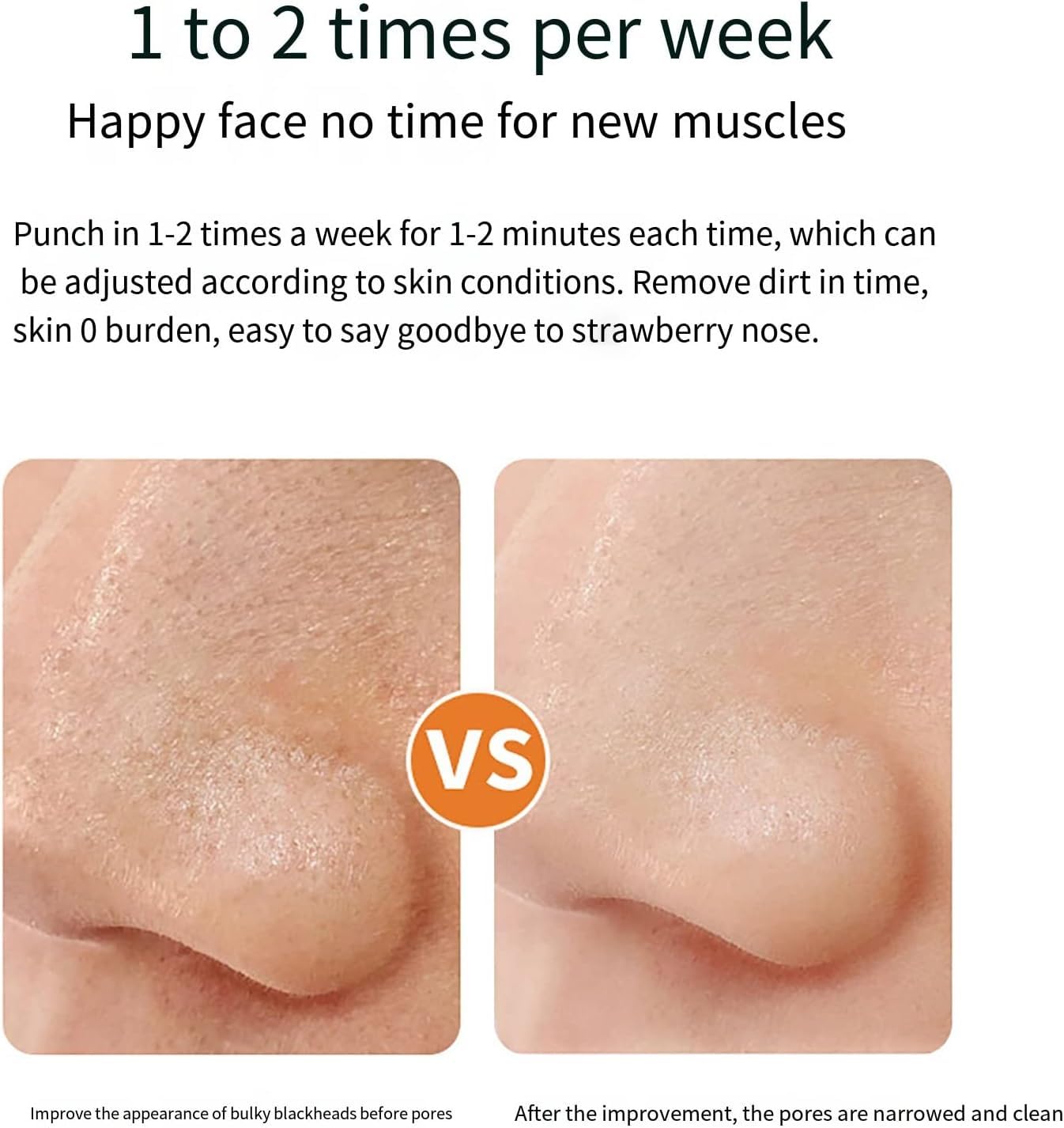Outil d'aspiration de points noirs – Aspirateur de pores for enlever les points noirs, nettoyeur de pores du visage, extracteur de boutons de nettoyage du visage, outil d'extraction de comédons